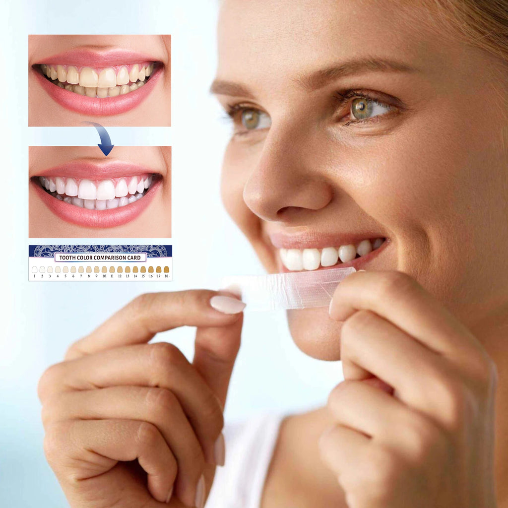 Tiras Blanqueadoras Dentales con Gel de Menta - 14 Unidades para una Sonrisa Brillante